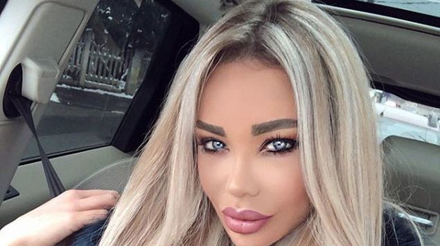 10 vedete care au apelat la chirurgia plastica!