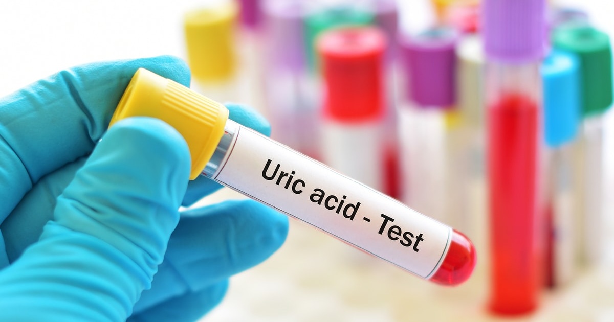 Remedii naturiste pentru reducerea nivelului de acid uric